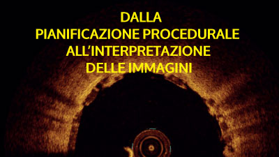 Dalla pianificazione procedurale all’interpretazione delle immagini