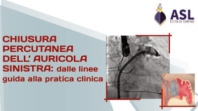 Chiusura percutanea dell'auricola sinistra: dalle LINEE GUIDA alla PRATICA